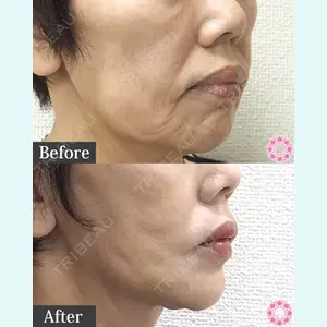 東京形成美容外科 池袋院 弓削田　浩主医師の症例