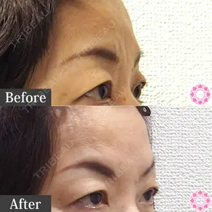 東京形成美容外科 池袋院 弓削田　浩主医師の症例