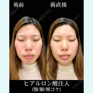 HAAB×DREAM BEAUTY CLINIC 東京本院 佐野 圭医師の症例