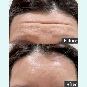 東京形成美容外科 池袋院 弓削田　浩主医師の症例