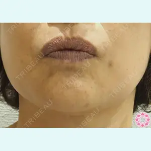 東京形成美容外科 池袋院 弓削田　浩主医師の症例