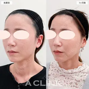 A CLINIC（エークリニック） 大阪院 田窪 賢志郎医師の症例