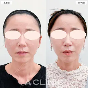 A CLINIC（エークリニック） 大阪院 田窪 賢志郎医師の症例