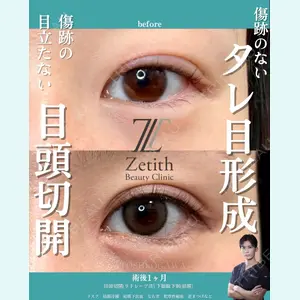 Zetith Beauty Clinic 銀座院 小川 悟史医師の症例