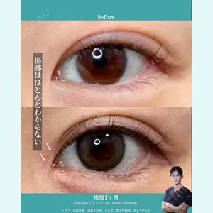 Zetith Beauty Clinic 銀座院 小川 悟史医師の症例