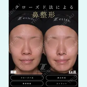 Zetith Beauty Clinic 福岡院 羽根 和秀医師の症例