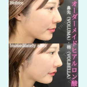 THE FIRST CLINIC 町田院 木暮 啓一郎医師の症例