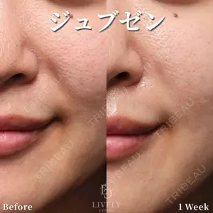 ライブリークリニック 大阪院の症例