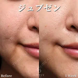 ライブリークリニック 大阪院の症例