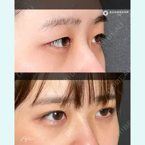 東京形成美容外科 船橋院 山崎 修吾医師の症例