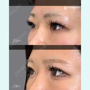 東京形成美容外科 池袋院 弓削田　浩主医師の症例