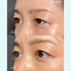 東京形成美容外科 船橋院 山崎 修吾医師の症例