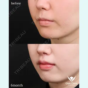 Otus Clinic 【オータスクリニック】 中 徳太郎医師の症例