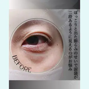 小倉美容外科/美容皮膚科 ビラビューティークリニック 大村 亞蘭医師の症例