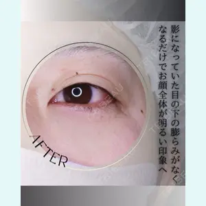 小倉美容外科/美容皮膚科 ビラビューティークリニック 大村 亞蘭医師の症例