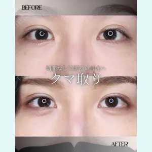 小倉美容外科/美容皮膚科 ビラビューティークリニック 大村 亞蘭医師の症例