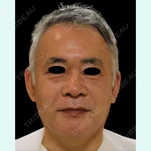 聖心美容クリニック 熱海院 小林 美幸（皮膚科）医師の症例