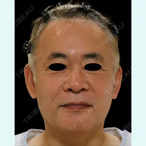 聖心美容クリニック 熱海院 小林 美幸（皮膚科）医師の症例