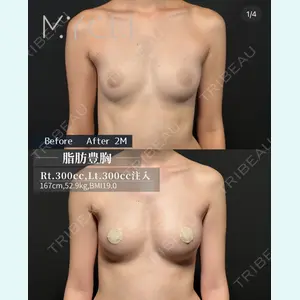 MYCLI【マイクリ】大阪・梅田院 三木 晶森医師の症例