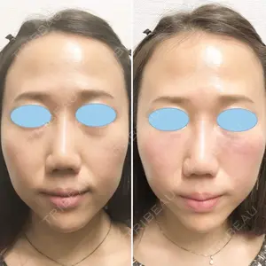 しのぶ皮膚科 蘇原しのぶ医師の症例