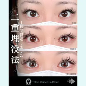 東京シンデレラ美容外科 池袋院 石井 達也医師の症例