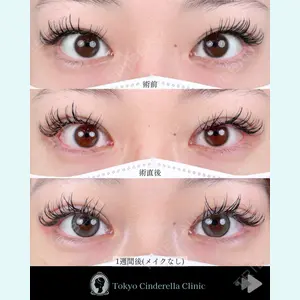 東京シンデレラ美容外科 池袋院 石井 達也医師の症例