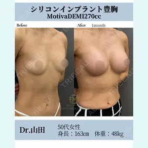 お茶の水美容形成クリニック 山田 淳生医師の症例