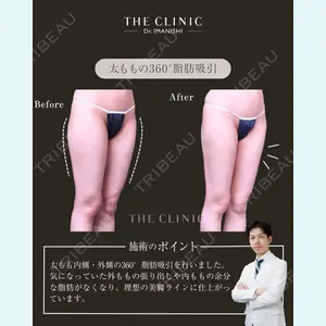 THE CLINIC（ザ・クリニック） 東京院 今西 理也医師の症例