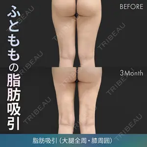 ジョウクリニック 高知院 溝渕　貴俊医師の症例