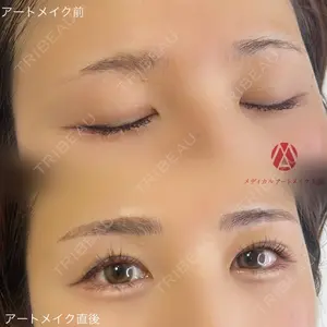 メディカルアートメイク大阪 ISHIDA AKARI医師の症例