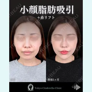 東京シンデレラ美容外科 池袋院 石井 達也医師の症例