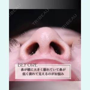 小倉美容外科/美容皮膚科 ビラビューティークリニック 大村 亞蘭医師の症例