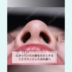 小倉美容外科/美容皮膚科 ビラビューティークリニック 大村 亞蘭医師の症例