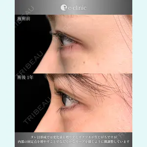 eクリニック 大阪院 八木 良太医師の症例