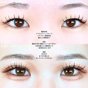 アリエル美容クリニック 大宮院 鈴木　桂介医師の症例