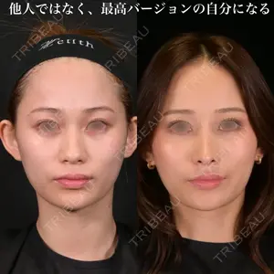 Zetith Beauty Clinic 銀座院 鉄 鑠医師の症例