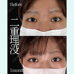 ネビュラクリニック 東京錦糸町院 岩切 琢磨医師の症例