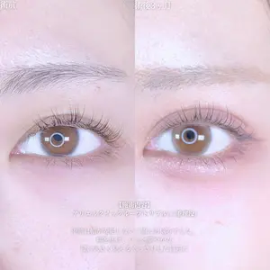 アリエル美容クリニック 郡山院 安齋 誠基医師の症例