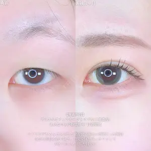 アリエル美容クリニック 郡山院 安齋 誠基医師の症例