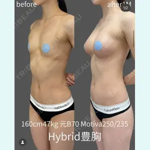 plume clinic 向山 綾子医師の症例