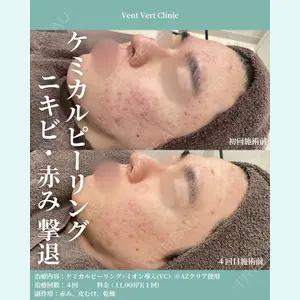 ヴァンヴェールクリニック 高槻院 李 愚姫医師の症例