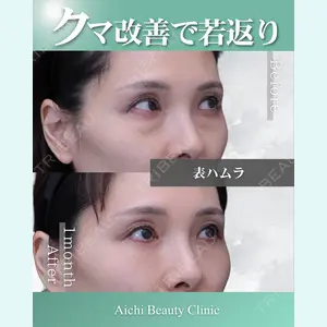 症例