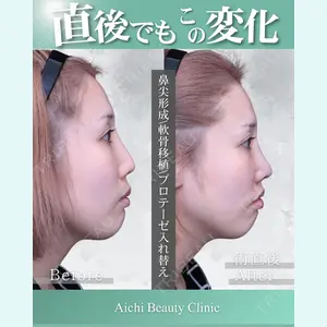 症例