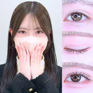 アリエル美容クリニック 水戸院 天白 典秀医師の症例