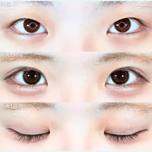 アリエル美容クリニック 横浜院 渡邉 光医師の症例