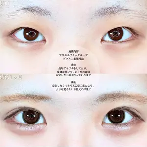 アリエル美容クリニック 横浜院 渡邉 光医師の症例