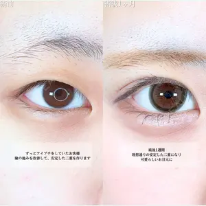 アリエル美容クリニック 横浜院 渡邉 光医師の症例