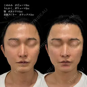 ルラ美容クリニック 池袋院 小海 元医師の症例