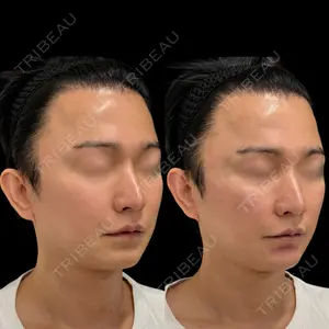 ルラ美容クリニック 池袋院 小海 元医師の症例