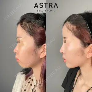 ASTRA BEAUTY CLINIC 塩満 惠子医師の症例